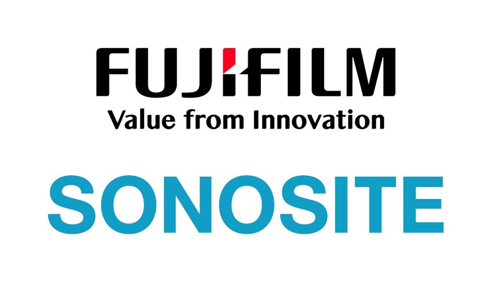 Sonosite
